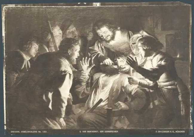 Dresden, Gemäldegalerie. No. 1251. G. Van Honthorst, Der Zahnbrecher